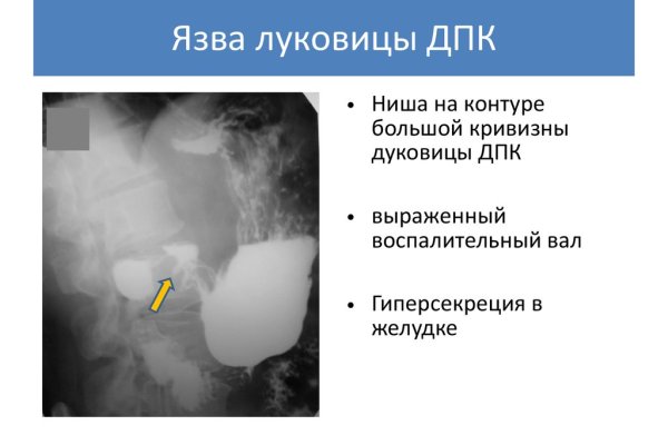 Ссылка кракен не работает